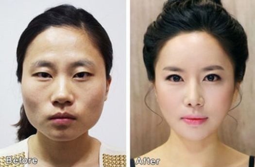 пластическая хирургия фото до и после